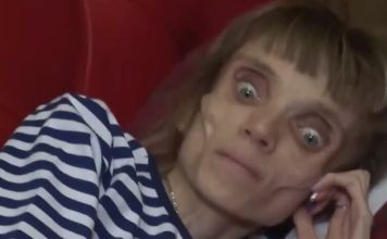 KRISTINA JE SPALA NA 17 KILOGRAMA, ljudi se prepadnu kada je vide: Hrana je postala njen neprijatelj, ranije je bila lepa kao san, evo kako je izgledala