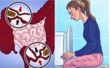 Danima niste bili na WC-u, muči vas kronični zatvor u stolici i osjećate se kao da ćete eksplodirati: evo kako ga se riješiti!