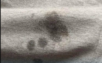 Ovoga se još niko nije sjetio: Svaku fleku sa odjeće skida 1 sastojak koji svi imamo u kući