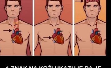 1 ZNAK NA KOŽI UKAZUJE DA JE VAŠE SRCE U LOŠEM STANJU: Ako ovo primijetite javite se doktoru ODMAH!
