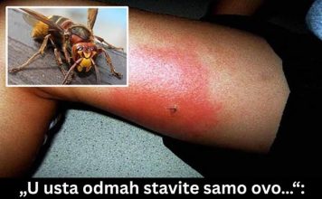 UJEO VAS JE STRŠLJEN? EVO ŠTA ODMAH URADITI! Doktorka objašnjava – prvih 5 minuta su presudne za vašu sigurnost!