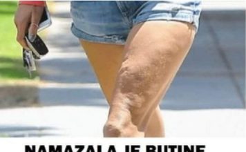 NAMAZALA JE BUTINE SIRĆETOM I OTIŠLA NA SPAVANJE: UJUTRU NIJE MOGLA DA VJERUJE KAKAV JE REZULTAT DOBILA