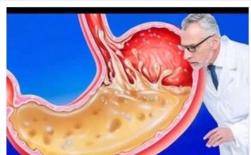 OVO JEDITE ZA VEČERU 3 DANA ZAREDOM: Nećete vjerovati šta će izaći iz vašeg stomaka