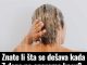 Znate li šta se dešava kada 7 dana ne operemo kosu? Rezultat zaprepastio mnoge