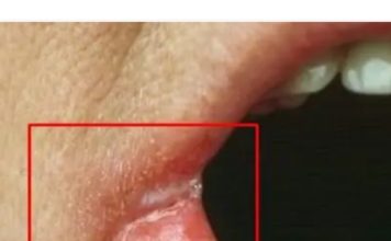 OPASNO PO ŽIVOT: Imate li neki od OVIH simptoma? Nagovještavaju nešto loše!