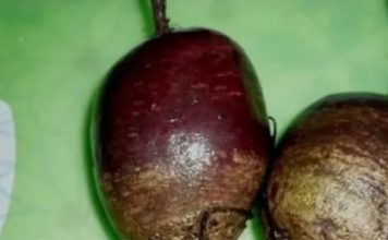 Obična cvekla čisti jetru kao usisivač – Ova domaća metoda detoksikuje cijelo tijelo za samo 7 dana!