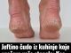 Jeftino čudo iz kuhinje koje spašava vaša stopala: Kao rukom rješava ispucale peta, gljivice i kurje oči