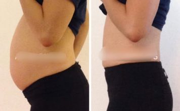 Želudac Vam Ne Vari Hranu I Stomak Vam Je Napuhan?: Odmah otiđite u kuhinju i NAPRAVITE OVO – preporodit ćete se!