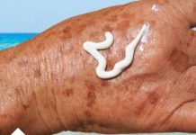 PRIMJETILI STE DA VAM SE POJAVLJUJU STARAČKE PJEGE : To je znak da imate ozbiljan problem sa jednim organom!