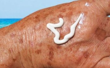 PRIMJETILI STE DA VAM SE POJAVLJUJU STARAČKE PJEGE : To je znak da imate ozbiljan problem sa jednim organom!