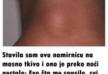 Stavila sam ovu namirnicu na masno tkivo i ono je preko noći nestalo: Evo šta me spasilo, svi ga imate u kući