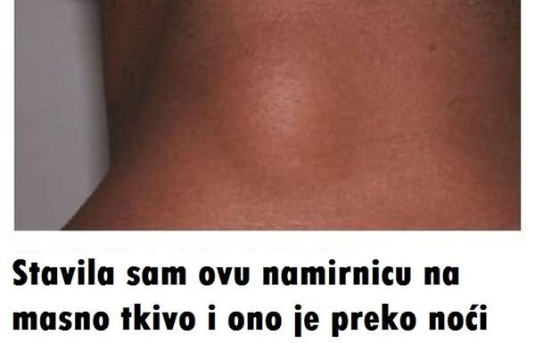 Stavila sam ovu namirnicu na masno tkivo i ono je preko noći nestalo: Evo šta me spasilo, svi ga imate u kući