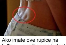 Ako imate ove rupice na leđima – znači samo jedno! Evo šta vam tijelo poručuje!