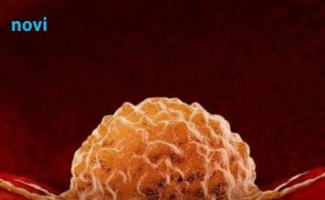 Previše ovog vitamina može povećati rizik od raka!