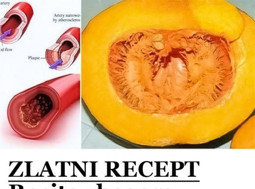 ZLATNI RECEPT: Recite ZBOGOM POVIŠENOM HOLESTEROLU, šećeru u krvi, MASNOĆI i trigliceridima…