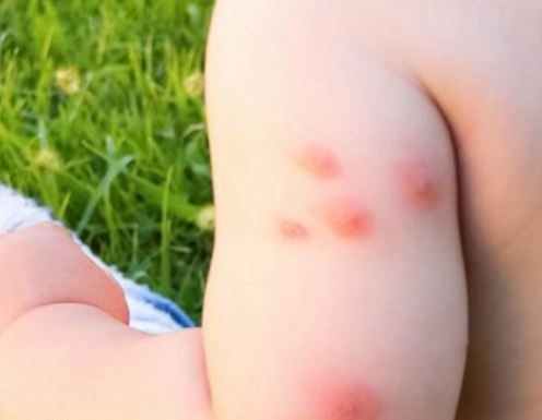 KOMARCI VAM PRAVE PAKAO OD ŽIVOTA? Samo isijecite OVO VOĆE na pola i ostavite u sobi, VIŠE IH NIKADA NEĆETE VIDJETI BLIZU!