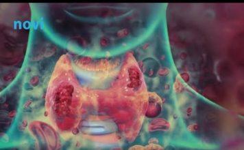 Ovih 7 simptoma raka grla ne smijete ignorisati! Često se miješaju sa bezazlenim infekcijama