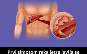 Prvi simptom raka jetre javlja se dok jedete – Mnogi ga zanemaruju, a znakovi su očigledni