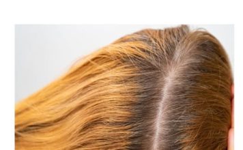 Kako prekriti izrastak bez farbanja? 6 superbrzih trikova koji uvek deluju