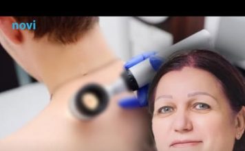 Najčešći karcinom na svijetu pogađa svaku petu osobu: Dermatolog savjetuje kako da ga prepoznate