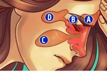 7 znakova da imate manjak magnezijuma u organizmu: ODMAH REAGUJTE