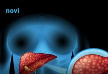 Tri simptoma koja ukazuju na moguće probleme s jetrom