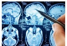 Najzdravije povrće na svijetu: Naučnici kažu da mozak može učiniti 11 godina mlađim