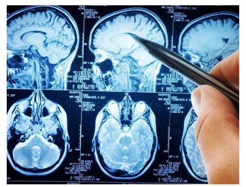 Najzdravije povrće na svijetu: Naučnici kažu da mozak može učiniti 11 godina mlađim