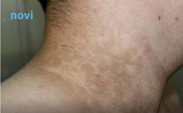 Ove simptome dijabetesa trebate znati: Ako osjetite ovo, javite se doktoru hitno