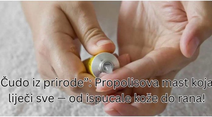 Čudo iz prirode”: Propolisova mast koja liječi sve — od ispucale kože do rane!