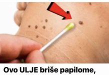 OVO ULJE briše papilome, bradavice, pa čak i gljivice – svaka kap je NEPROCJENJIVA!