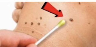 OVO ULJE briše papilome, bradavice, pa čak i gljivice – svaka kap je NEPROCJENJIVA!