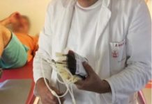 OVI SIMPTOMI UKAZUJU NA ZGRUŠENU KRV U TIJELU: Slijedi VAM SRČANI I MOŽDANI UDAR- U VELIKOJ ste OPASNOSTI