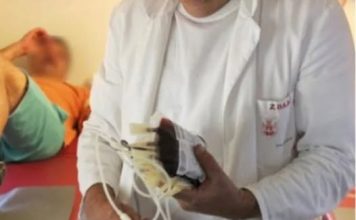 OVI SIMPTOMI UKAZUJU NA ZGRUŠENU KRV U TIJELU: Slijedi VAM SRČANI I MOŽDANI UDAR- U VELIKOJ ste OPASNOSTI