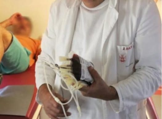 OVI SIMPTOMI UKAZUJU NA ZGRUŠENU KRV U TIJELU: Slijedi VAM SRČANI I MOŽDANI UDAR- U VELIKOJ ste OPASNOSTI