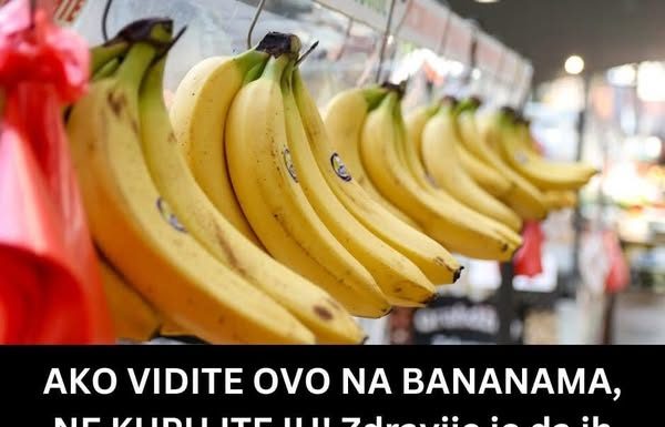 AKO VIDITE OVO NA BANANAMA, NE KUPUJTE IH! Zdravije je da ih ne pojedete, nego ovakve da uzmete