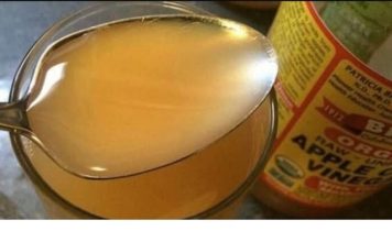 10 Nevjerovatnih Svojstava Jabukovog Sirćeta: Zašto Je Dobar Prije Spavanja