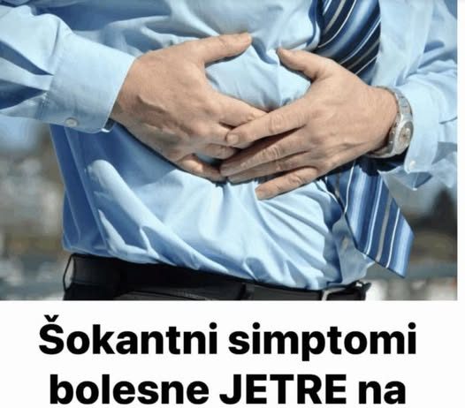 Šokantni simptomi bolesne JETRE na rukama i stomaku