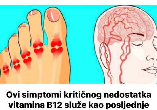 Ovi simptomi kritičnog nedostatka vitamina B12 služe kao posljednje upozorenje: TO JE UZROK BROJ 1 OVIH VAŠIH ZDRAVSTVENIH PROBLEMA