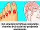 Ovi simptomi kritičnog nedostatka vitamina B12 služe kao posljednje upozorenje: TO JE UZROK BROJ 1 OVIH VAŠIH ZDRAVSTVENIH PROBLEMA