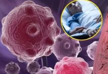 8 namirnica koje smanjuju upale i jačaju imunitet — savršen početak dana