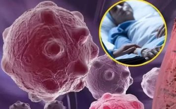 8 namirnica koje smanjuju upale i jačaju imunitet — savršen početak dana
