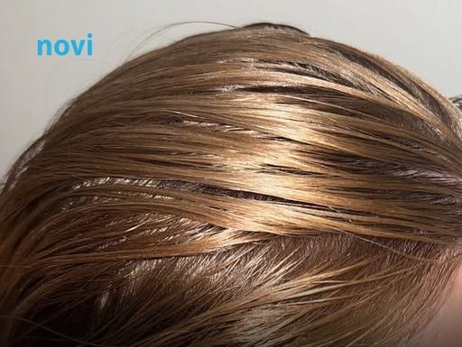 Operete kosu, a već sutradan je masna? Frizeri otkrili trik kako da vam bude čista i nekoliko dana