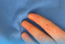 Doktorica upozorava: 90 posto srčanih udara povezano je s jednom jutarnjom navikom