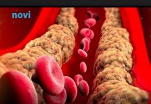 Holesterol ne skače od mesa, već od ove 2 stvari koje su smrt za jetru i samo gomilaju masnoću