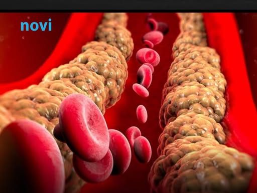 Holesterol ne skače od mesa, već od ove 2 stvari koje su smrt za jetru i samo gomilaju masnoću