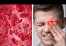 UPOZORENJE! OVO SU SIMPTOMI NISKOG ŽELJEZA U KRVI: Tijelo vas upozorava JEDNIM SIMPTOMOM – ODMAH REAGUJTE