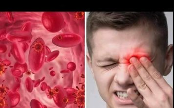 UPOZORENJE! OVO SU SIMPTOMI NISKOG ŽELJEZA U KRVI: Tijelo vas upozorava JEDNIM SIMPTOMOM – ODMAH REAGUJTE