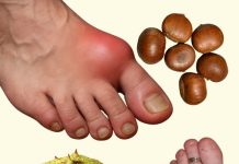 DIVLJI KESTEN – moćan lijek za otečene noge i bolju cirkulaciju