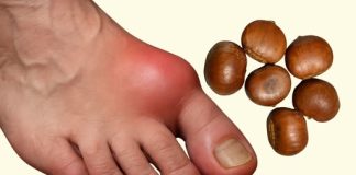 DIVLJI KESTEN – moćan lijek za otečene noge i bolju cirkulaciju